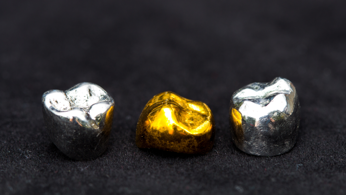 gold and silver crowns from teeth